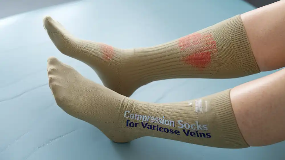 compression socks for varicose vein