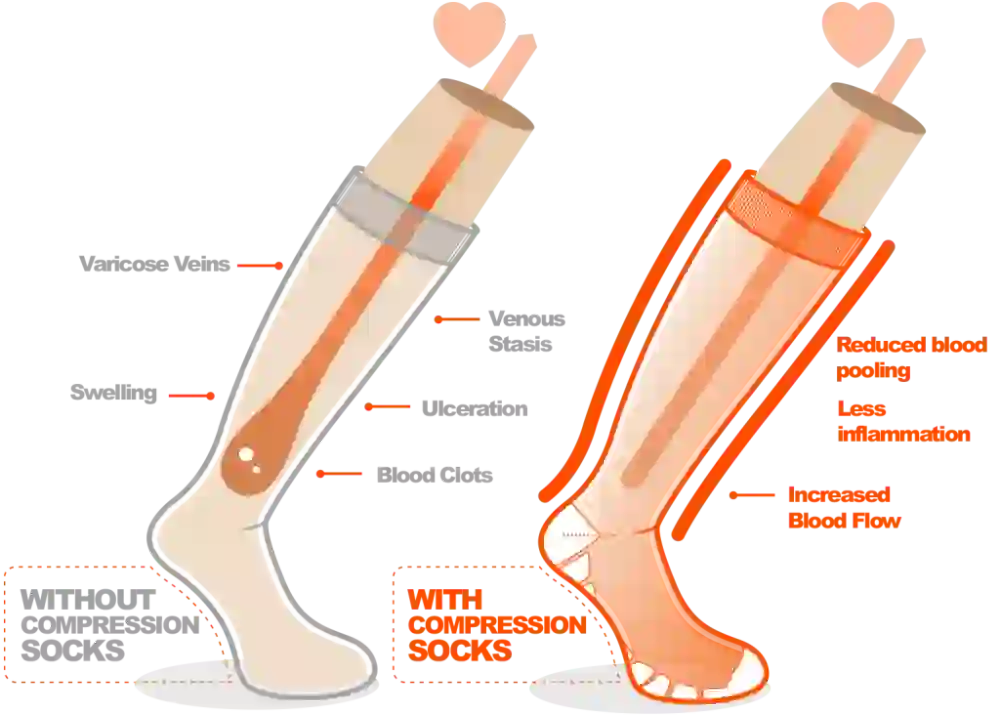 function of compression socks