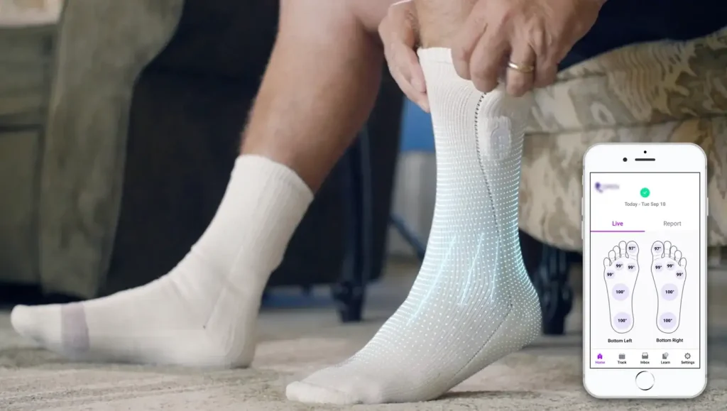 smart socks