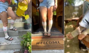 wearing compression socks in summer