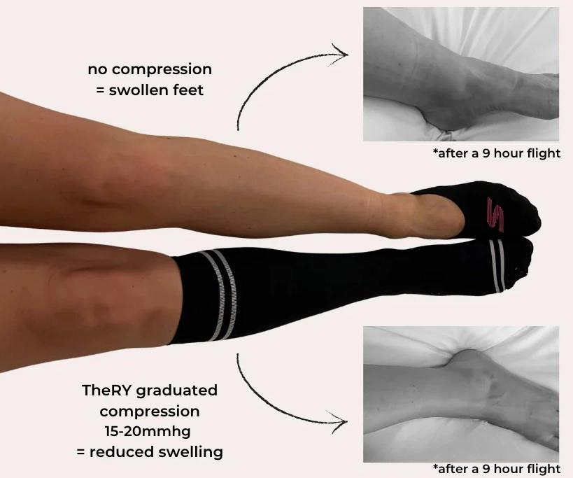 compression socks for swelling 1.