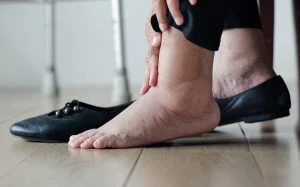 compression socks for swelling 2.