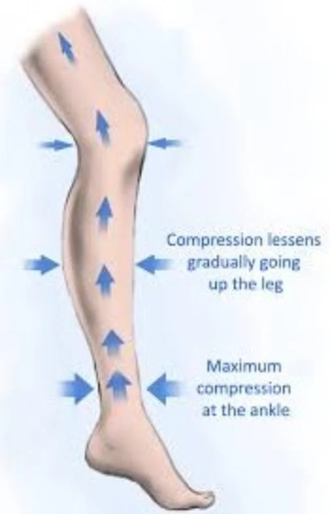 compression socks417.