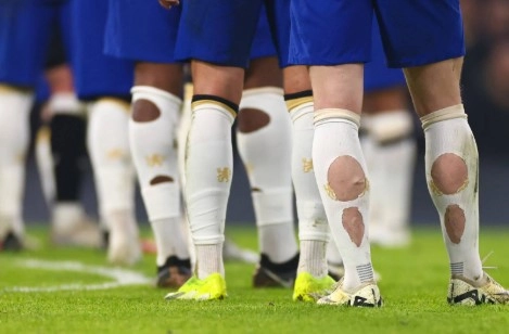 Soccer game: players showing torn and worn white socks on the field