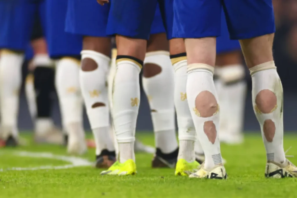 Diagram showing pressure points on a football sock where players commonly cut holes