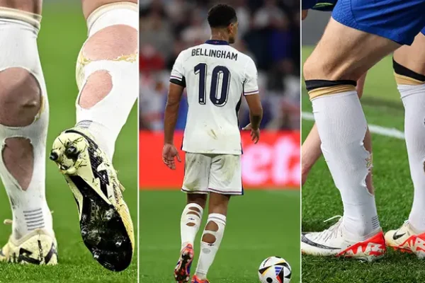 An image showing soccer players Jude Bellingham and others with holes cut in their socks.