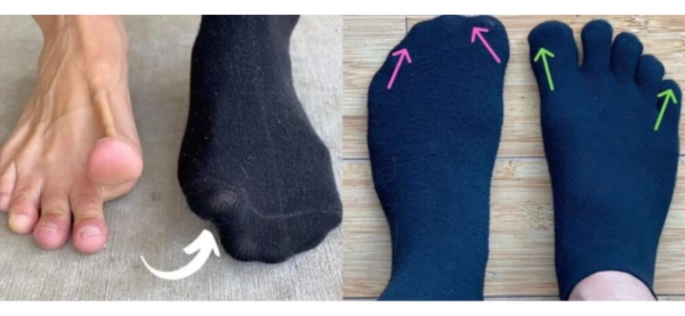 Illustration comparing traditional socks and toe socks with individual toes side by side