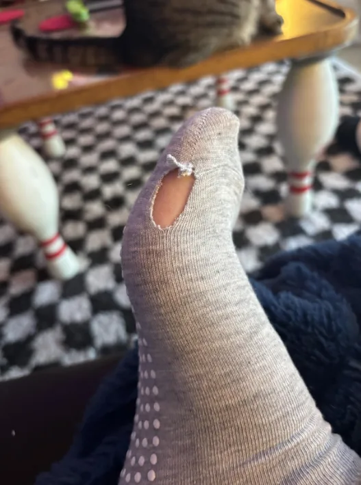 Example of loose stitching and thread defects in cheap grip socks