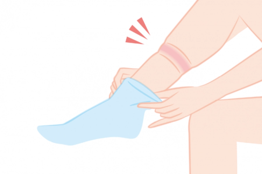 Legs with red marks from long sock wear