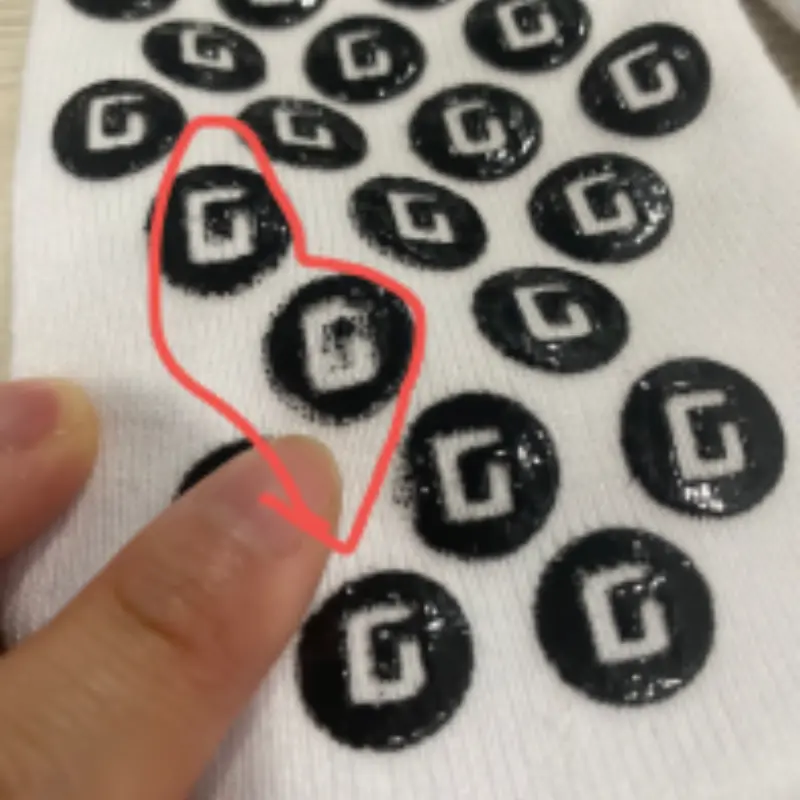 Peeling defect grips