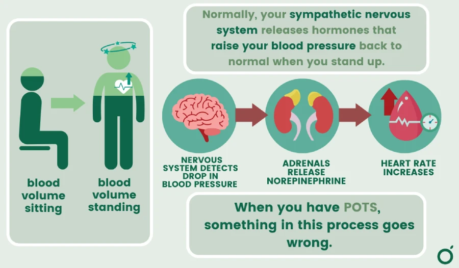 Symptoms of POTS, including lightheadedness and increased heart rate when standing.