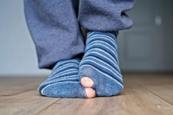 Close up of a worn sock with a hole at the big toe showing fabric damage