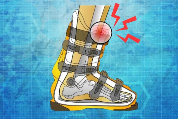 Diagram showing shin bang from ski boot tongue pressure and how ski socks cushion impact on the shin
