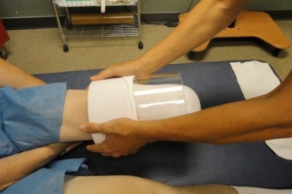 Medical grade shrinker stump sock designed for overnight use under clinical supervision to control swelling